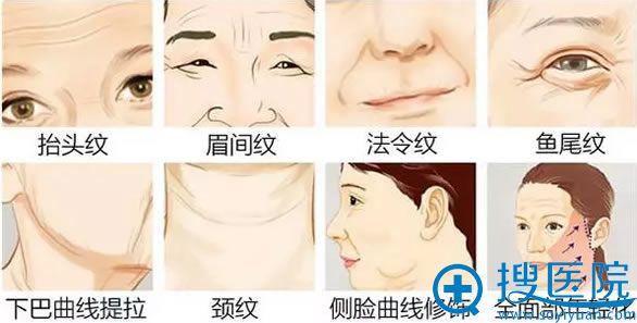 需要线雕部位示意图 需要线雕部位示意图