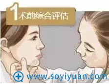 线雕术前综合评估 线雕术前综合评估
