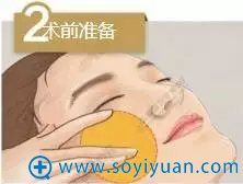 线雕术前准备示意图 线雕术前准备示意图