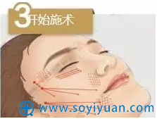 面部线雕过程示意图 面部线雕过程示意图