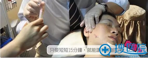 面部线雕提升术手术过程 面部线雕提升术手术过程