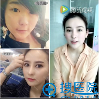 术前术后对比照 术前术后对比照