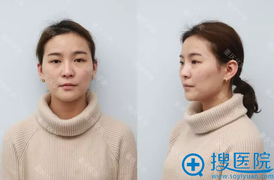 术前留影 术前留影