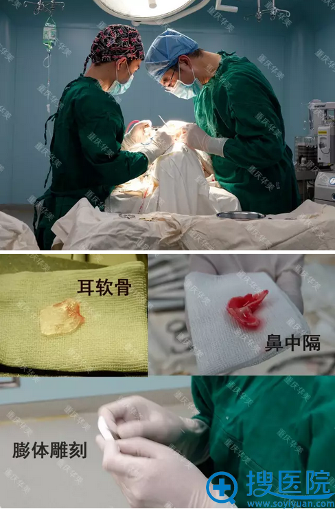 重庆华美杨健医生正在为我做手术 重庆华美杨健医生正在为我做手术