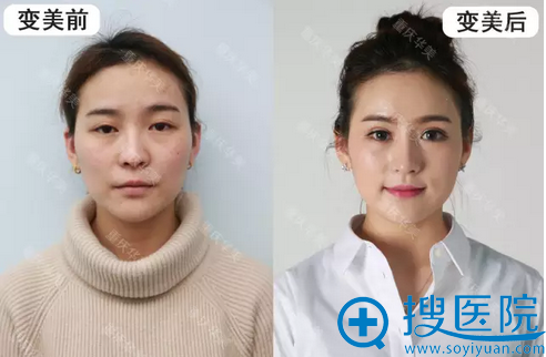 30天啦,看看我的前后对比照 30天啦,看看我的前后对比照