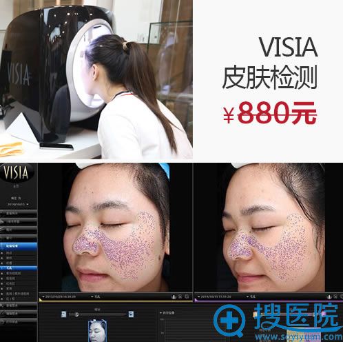 广州曙光五一优惠活动:Visia皮肤检测免费送 广州曙光五一优惠活动:Visia皮肤检测免费送