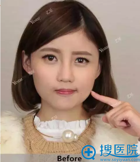 术前留影 术前留影