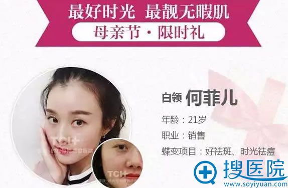 重庆时光整形医院案例对比图 重庆时光整形医院案例对比图