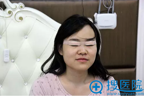 双眼皮+开眼角术后 双眼皮+开眼角术后