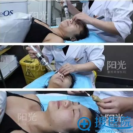 美人鱼祛斑治疗照片 美人鱼祛斑治疗照片