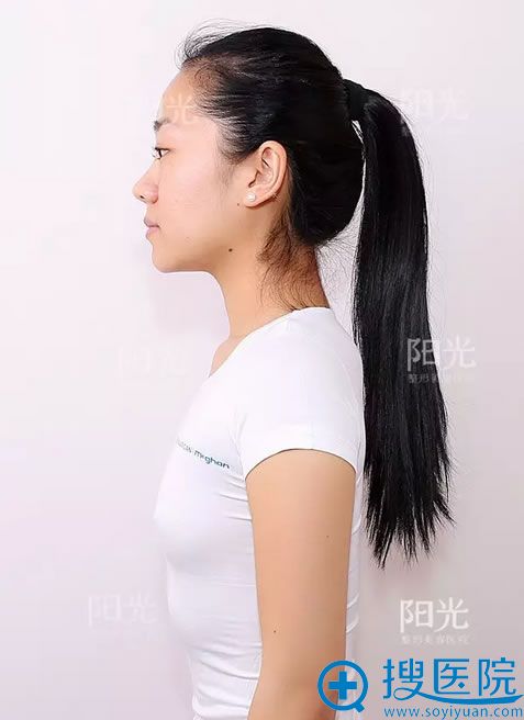 美人鱼丰胸术前留档照片 美人鱼丰胸术前留档照片
