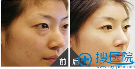 零妆素颜 无暇裸肌 零妆素颜 无暇裸肌