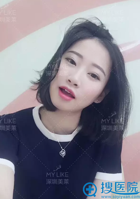 4D丝雾眉术后效果 4D丝雾眉术后效果