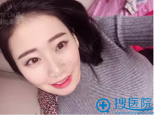 4D丝雾眉术后一个月效果 4D丝雾眉术后一个月效果