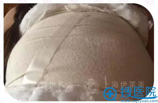 隆胸术后天,麻药散了很痛 隆胸术后天,麻药散了很痛