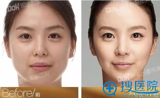 铜雀台前后对比 铜雀台前后对比