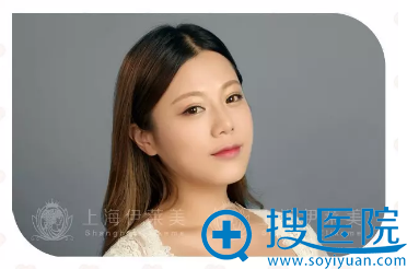 隆鼻+垫下巴术后一年效果 隆鼻+垫下巴术后一年效果