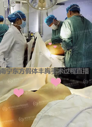 现场实拍南宁东方假体丰胸手术全过程 直击手术前后惊人对比