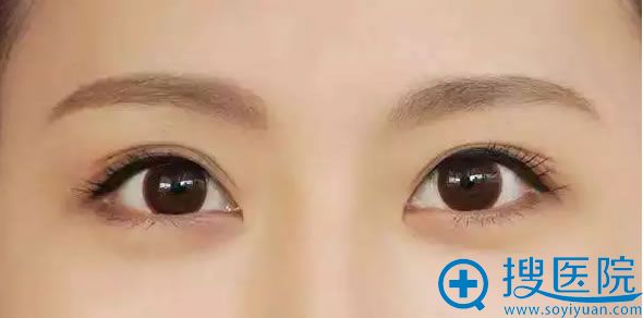 【中山美南华科普】哪种韩式半眉形自然适合自己