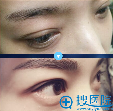 <!--<i data=20240710 data-id=12678></i>-->韩式半纹眉效果展示 <!--<i data=20240710 data-id=12678></i>-->韩式半纹眉效果展示