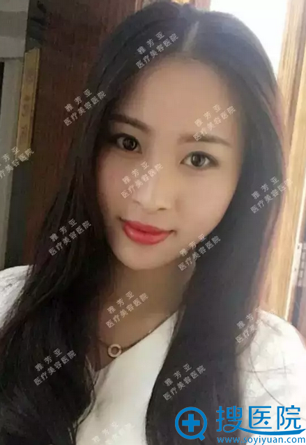 现在的我,面部轮廓清晰多了 现在的我,面部轮廓清晰多了