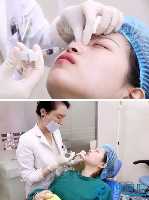术中注射玻尿酸隆鼻丰下巴 术中注射玻尿酸隆鼻丰下巴