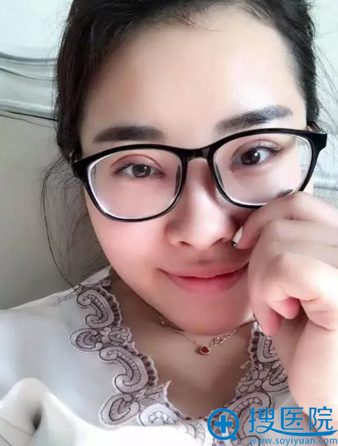 双眼皮第二天的样子 双眼皮第二天的样子
