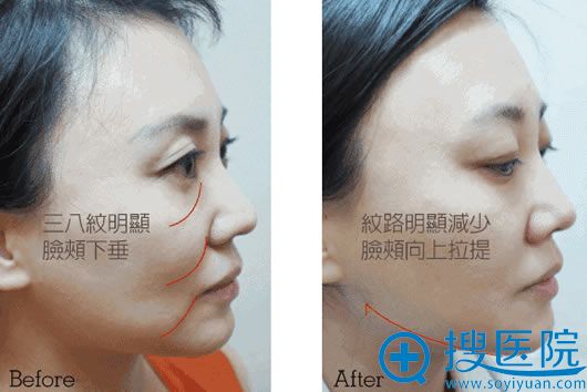 贵阳华美案例图 贵阳华美案例图