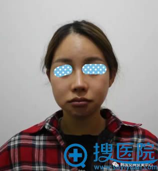 在韩国女神整形术前照 在韩国女神整形术前照