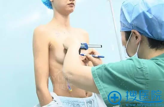徐英主任正在为我进行假体隆胸手术设计 徐英主任正在为我进行假体隆胸手术设计