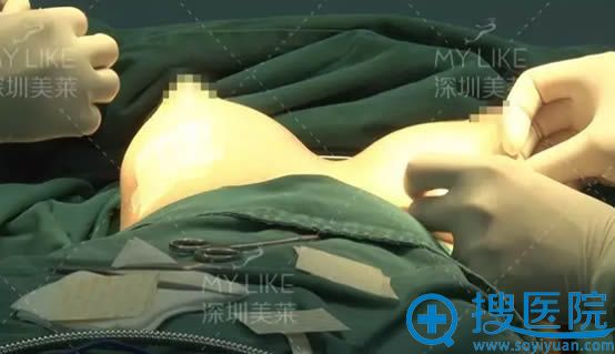 徐英主任正在为我进行术后缝合 徐英主任正在为我进行术后缝合