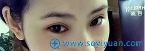 20170522_1495422988989080.png image.png