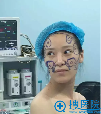 ����֬���沿�����ǰ����