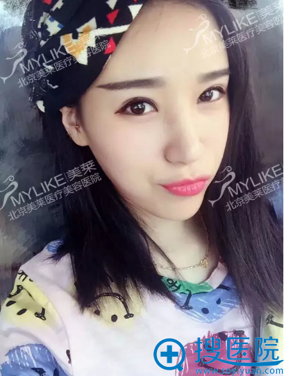 ����֬���沿�������������