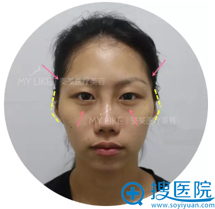 ����֬���沿������˰���