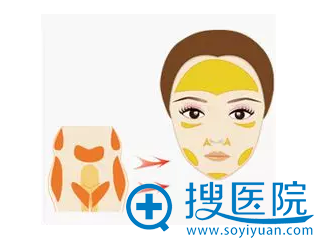 ����֬���沿���ԭ��ͼ