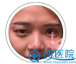 术前艺星<span style= 术前艺星<span style=