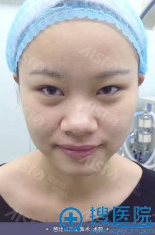 �人��˼������ҽԺ�轺¡��ʧ���޸����� ����¡���ػ�����