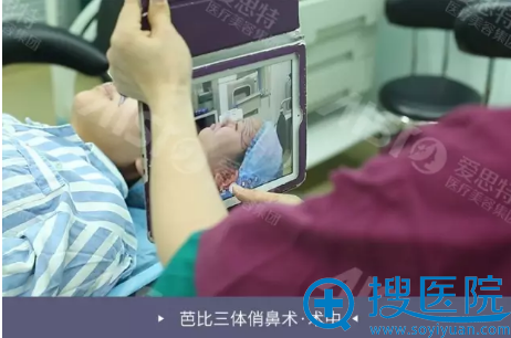 爱思特医生鼻修复术前画线 爱思特医生鼻修复术前画线