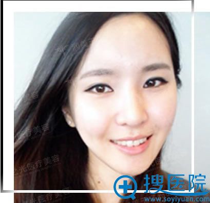 术后一个月恢复效果 术后一个月恢复效果