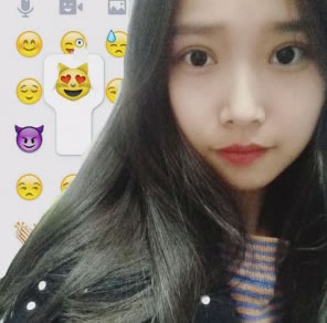 实拍:西安悦华王爱琴双眼皮一个月恢复案例 立刻拥有芭比电眼