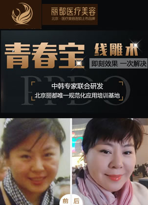 北京丽都整形医生石冰ppdo线雕案例 即刻恢复年轻如初的脸蛋