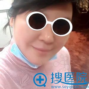 脸部线雕手术第3天_北京丽都 脸部线雕手术第3天_北京丽都