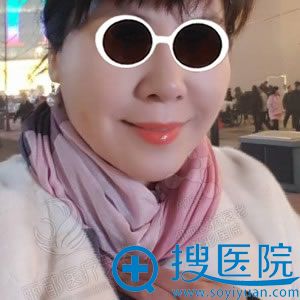 面部线雕除皱手术第15天照片 面部线雕除皱手术第15天照片
