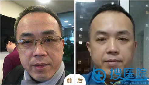 北京丽都宋总亲自体验线雕效果 北京丽都宋总亲自体验线雕效果