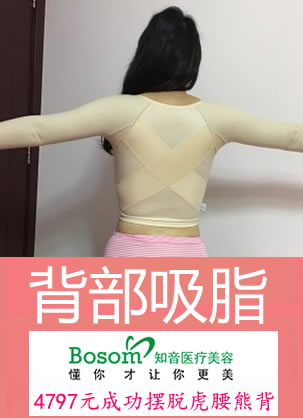 ����֪��������������֬���� 4797Ԫ�ɹ����ѻ����ܱ��ָ첲