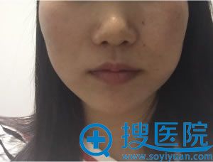 <!--<i data=20240710 data-id=7741></i>-->注射天 <!--<i data=20240710 data-id=7741></i>-->注射天