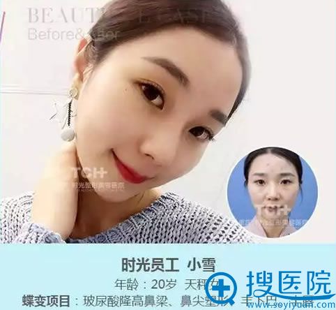重庆时光隆鼻案例图 重庆时光隆鼻案例图