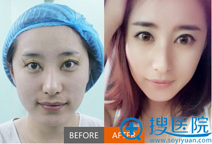 <!--<i data=20240710 data-id=12014></i>-->˫��Ƥ����