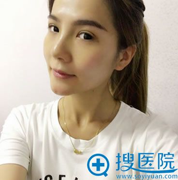 拆线之后的恢复效果 拆线之后的恢复效果